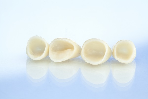 When Is A Dental Crown Necessary?