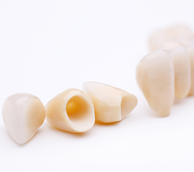 Gladstone Dental Crowns and Dental Bridges