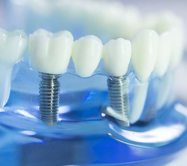 Gladstone Dental Implants