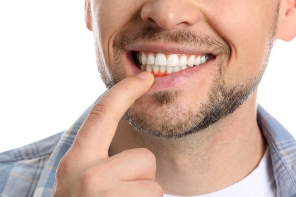 Why Gum Disease Prevention Is So Important