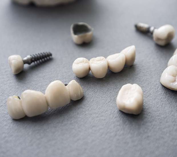 Gladstone The Difference Between Dental Implants and Mini Dental Implants