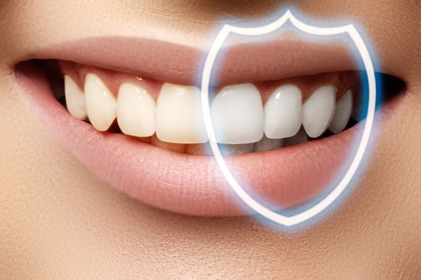 Tips For Teeth Whitening Aftercare